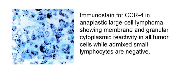 Anti-human CCR-4 Monoclonal