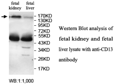 Anti-CD13