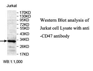 Anti-CD47