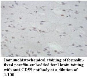 Anti-CD59