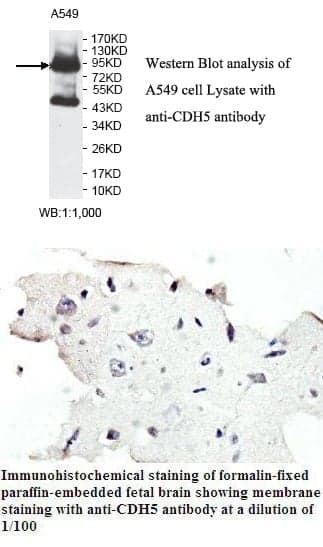 Anti-CDH5