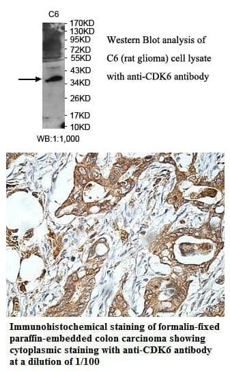 Anti-CDK6