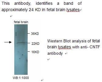 Anti-CNTF