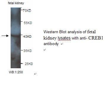 Anti-CREB1