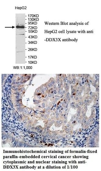 Anti-DDX3X