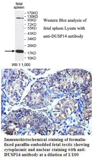 Anti-DUSP14