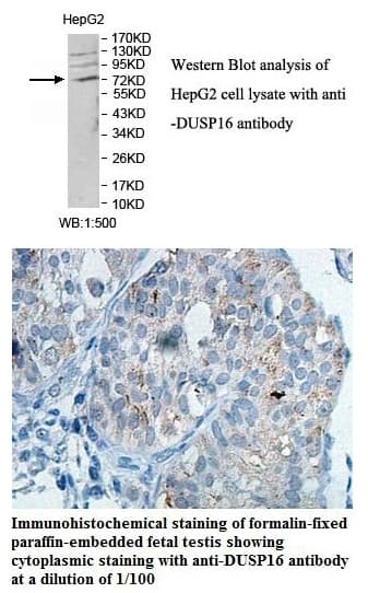 Anti-DUSP16