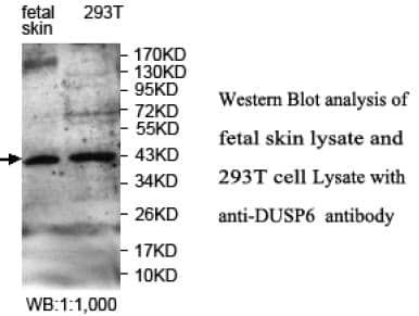 Anti-DUSP6