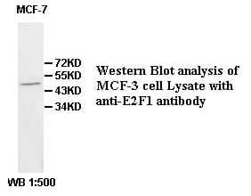 Anti-E2F1