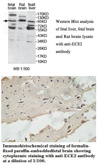 Anti-ECE2