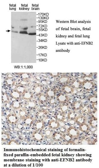Anti-EFNB2
