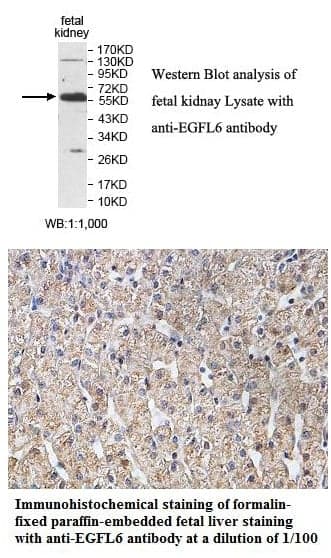 Anti-EGFL6