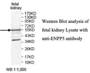 Anti-ENPP5