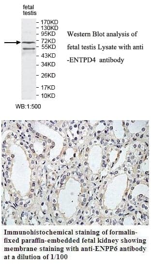 Anti-ENTPD1