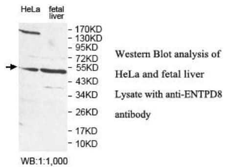 Anti-ENTPD8