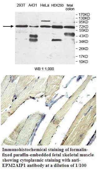 Anti-EPM2AIP1