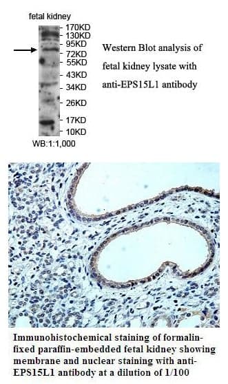 Anti-EPS15L1
