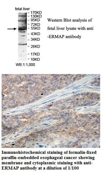 Anti-ERMAP