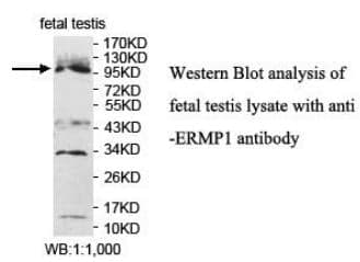 Anti-ERMP1