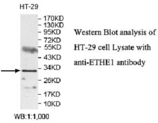 Anti-ETHE1