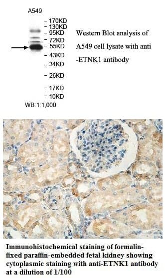 Anti-ETNK1