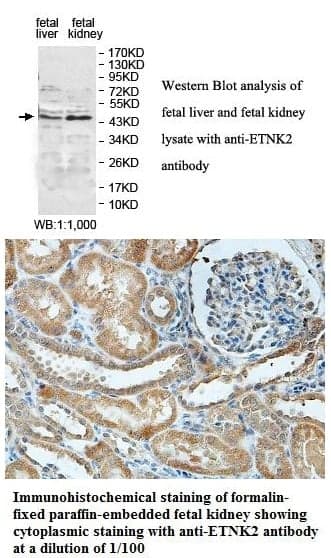 Anti-ETNK2