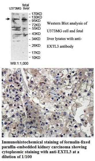 Anti-EXTL3