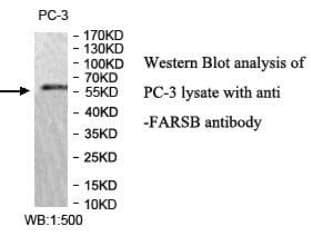 Anti-FARSB