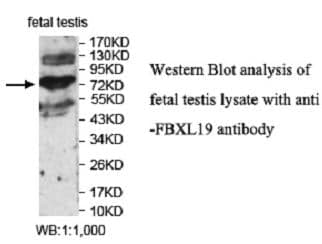 Anti-FBXL19