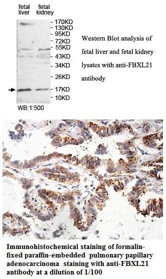 Anti-FBXL21