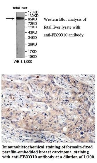 Anti-FBXO10