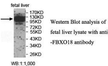 Anti-FBXO18
