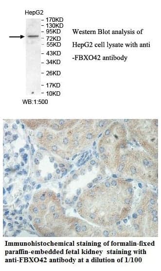 Anti-FBXO42