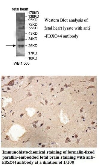 Anti-FBXO44