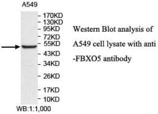Anti-FBXO5
