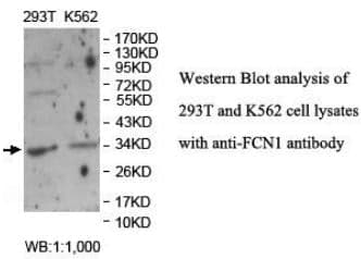 Anti-FCN1
