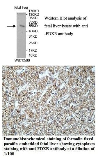 Anti-FDXR