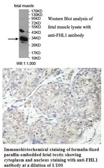 Anti-FHL1