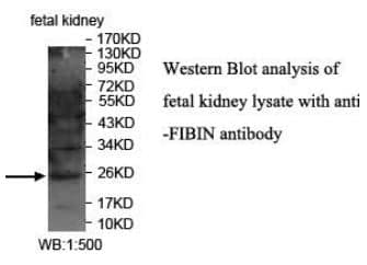 Anti-FIBIN