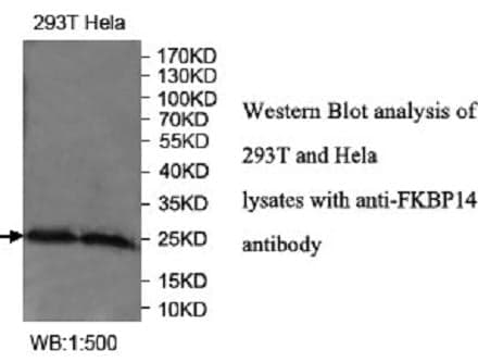 Anti-FKBP14