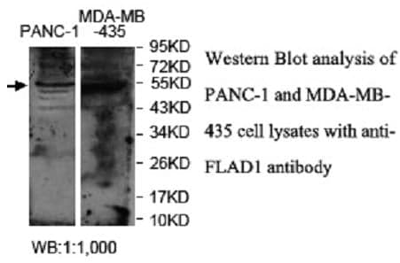 Anti-FLAD1