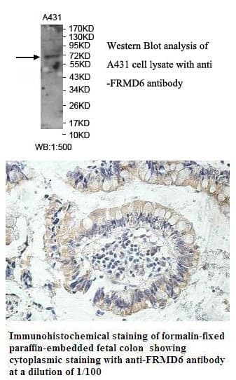 Anti-FRMD6