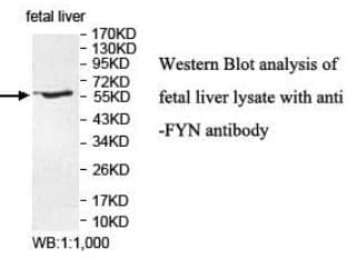 Anti-FYN