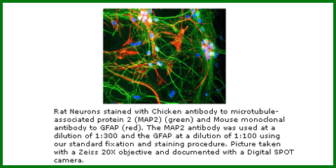Anti-GFAP (Mouse Monoclonal)