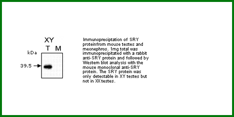 Anti-SRY (Mouse Monoclonal)