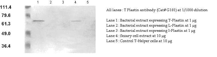 Anti-T Plastin Rabbit Polyclonal