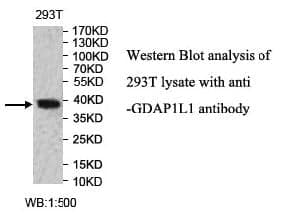 Anti-GDAP1L1