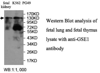 Anti-GSE1
