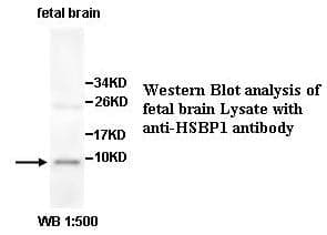 Anti-HSBP1