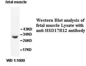 Anti-HSD17B12